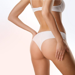 Woman with reduced love handles and thighs after using Lemon Bottle treatment